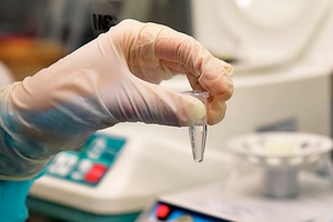 У переболевших COVID-19 вырабатывается иммунитет к вирусу
