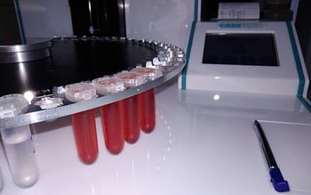 Прибор для максимально быстрого измерения глюкозы и лактата в крови поступил в клинико-диагностическую лабораторию Республиканского кардиодиспансера